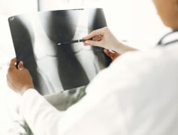5 Kiat Mencegah Osteoporosis demi Tulang Kuat