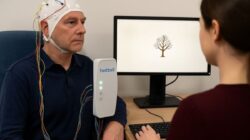 Alzheimer: Penyakit Otak Serius pada Lansia
